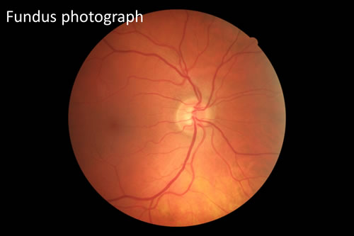 Fundus