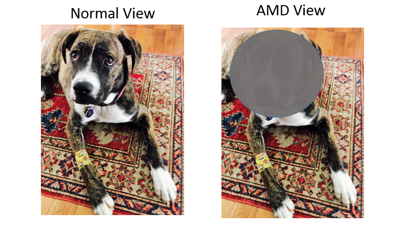 AMD